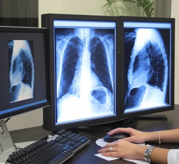 O Instituto Patris convida todos os interessados para participarem da licitação que visa contratação de serviços em radiologia e diagnóstico por imagens